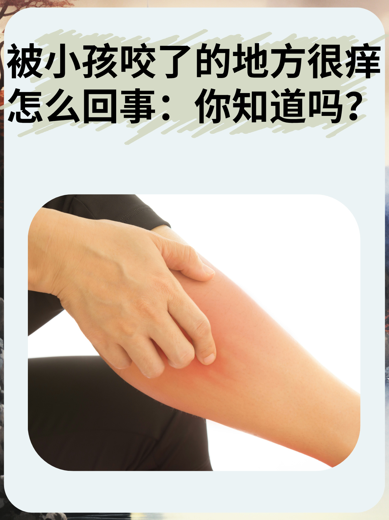 详细阅读:伤口痒(伤口痒怎么缓解) 伤口痒(伤口痒怎么缓解)